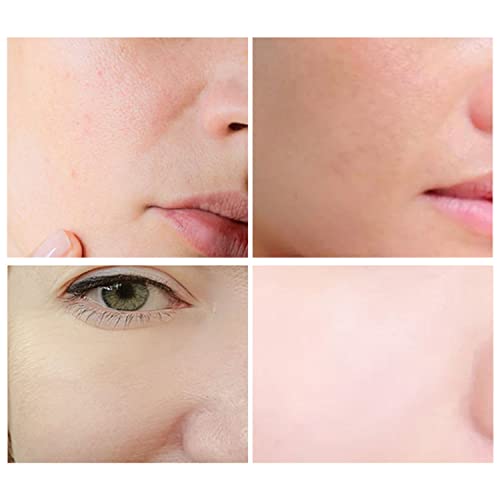 DISAAR Beauty 92% Aloe Vera Extract Repair Cream Soothing Moisturizing Essence Anti-Acne Balance Oil 120ml/4.06fl.oz