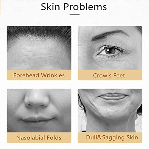 AICHUN BEAUTY Natural Rice Extract Hydrate Facial Mask Moisturizing Anti-Acne Purifying Refine Wrinkles 25ml/0.84fl.oz (10 PACK)