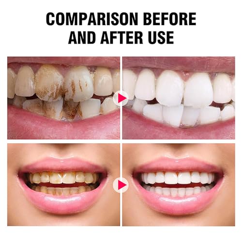 DISAAR BEAUTY Smokers Tooth Powder Remove Tobacco Stains Whitens Teeth Refreshes Breath Amino Acid Lemon Extract 50g / 1.69fl.oz