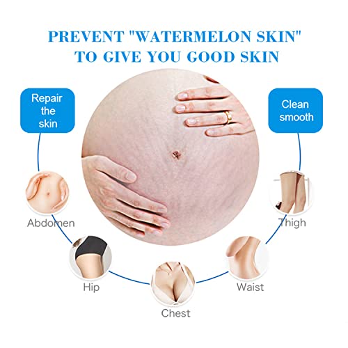 AICHUN BEAUTY Anti-Stretch Mark Essence Soap Removes Stretch Marks Organic 72% Hand Cold-Pressed Made 100g/3.38fl.oz