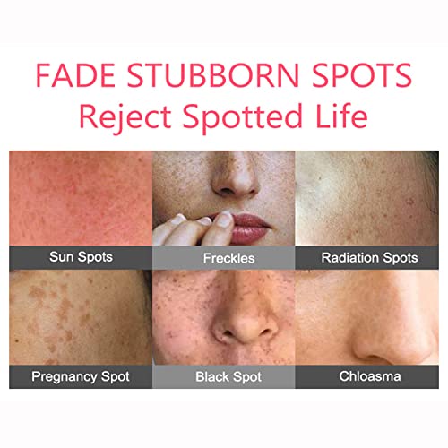 AICHUN BEAUTY Anti-Freckle Cream Cleansing Skin Care Fix Sunburn Makes Skin Silky Smooth 20g / 0.68fl.oz