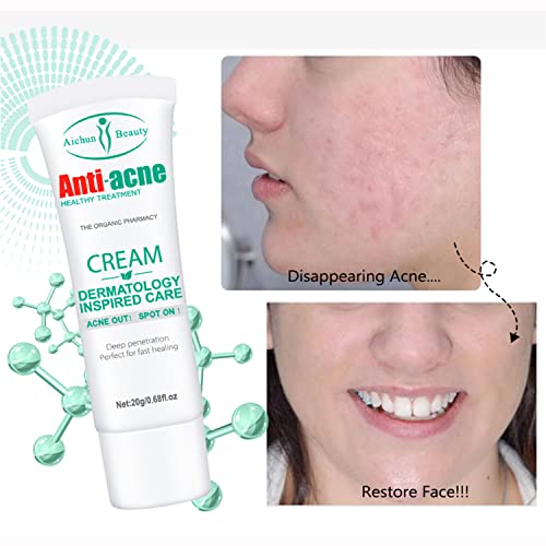 AICHUN BEAUTY Anti-Acne Cream Treats Pimple Clogged Pores Oil Control Reduces Acne Scars Shrinks Pores 20g / 0.68fl.oz