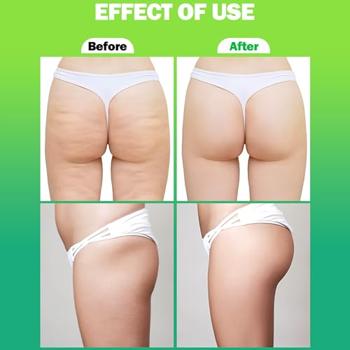 AICHUN BEAUTY Hip Up Firming Lifting Essensial Oil Capsules 3 Days Effect Moisturizing Nourishing 400mg x 90pcs
