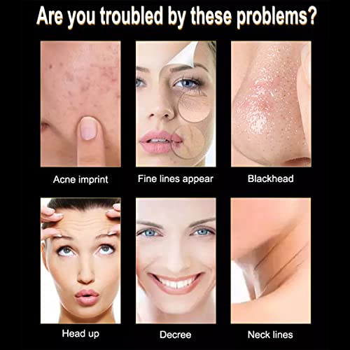 AICHUN BEAUTY 24K Gold Snail Peel-Off Mask Purifying Repair Anti-Wrinkle 150ml/5.07FL.OZ