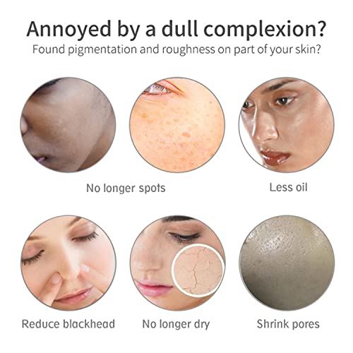 AICHUN BEAUTY Essence Soap Natural Rice Extract Hydrate Deep Cleaning Detox Exfoliation Remove Black Head Resist Acnes Reduce Acne Scars Repair Damage 100g/3.38fl.oz