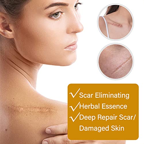 Aichun Beauty Removal Scar Premium Compound Essential Oil Repair Cells Reduces Scars Resists Acnes 30ml/1fl.oz
