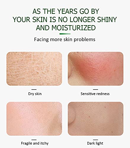 AICHUN BEAUTY Face Serum Soothes Moisturizing Anti-Acne Repair Facial Skin Care 30ml