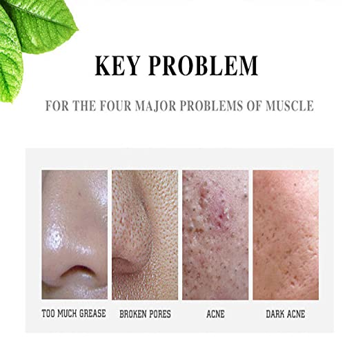 AICHUN BEAUTY Face Acne Cleaning Cream Skin Care Remove Repair Comedone Pimple Acne Face Acne Cream