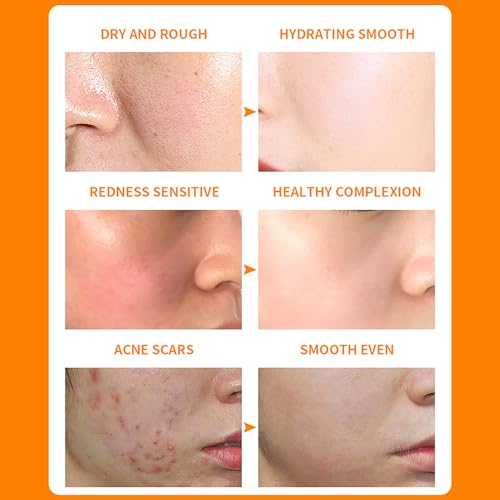 DISAAR Beauty Vitamin C Collagen Moisturizing Gel Orance Extract After Sun Repair Soothing Refines Pores Anti-Oxidation 300g / 10.14fl.oz