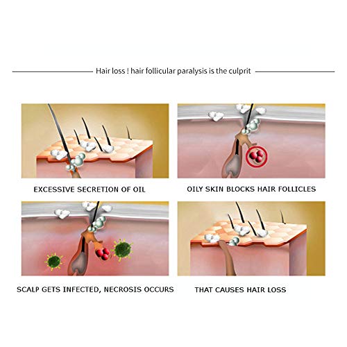 DISAAR BEAUTY Hair Growth Essential Oil Natural Plant Dry Growth Essence Anti Hair Loss Scalp Treatments Genseng Raise Dense 30g