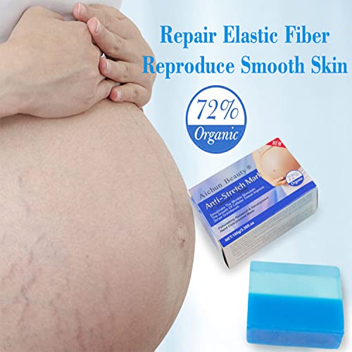 AICHUN BEAUTY Anti-Stretch Mark Essence Soap Removes Stretch Marks Organic 72% Hand Cold-Pressed Made 100g/3.38fl.oz