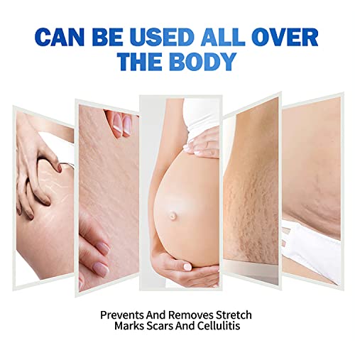 AICHUN BEAUTY Anti-Stretch Mark Essential Oil Capsules Prevents Removes Stretch Marks Scars Cellulitis 400mgx90pcs