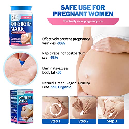 AICHUN BEAUTY Anti-Stretch Mark Essential Oil Capsules Prevents Removes Stretch Marks Scars Cellulitis 400mgx90pcs