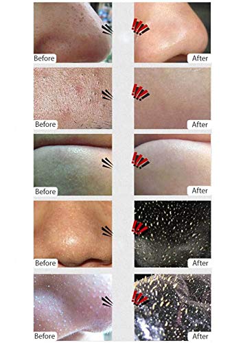 AICHUN BEAUTY Complex Black Mask Remove Blackhead Deep Cleansing Blackhead Remover Purifying Peel Face Mask 120ml