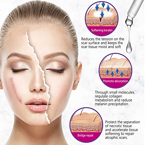 AICHUN BEAUTY Scars Repair Essence Lavender Extract Essential Oil Anti Scar Repair Cells Shiny Smooth Skin Care 30ml/1.01fl.oz