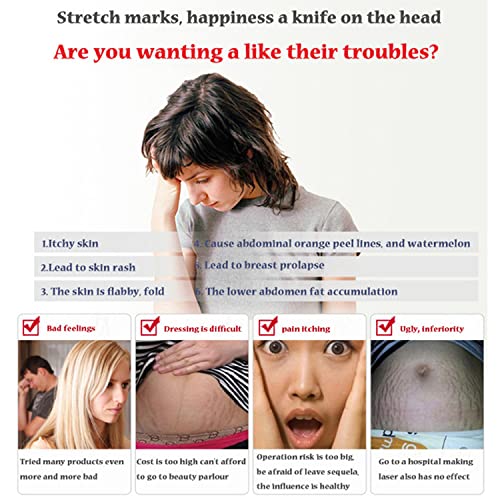 AICHUN BEAUTY Stretch Marks Cream Snail Extract Reduce Skin Scars Remove Damaged Skin Cells 120g/4.23oz