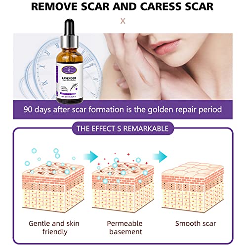 AICHUN BEAUTY Scars Repair Essence Lavender Extract Essential Oil Anti Scar Repair Cells Shiny Smooth Skin Care 30ml/1.01fl.oz