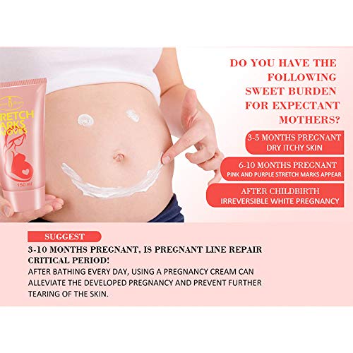 AICHUN BEAUTY Pregnancy Cream Stretch Mark Remover Scars Repair Cellulites Lotion Cream 150ml