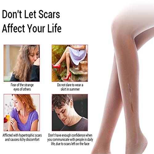 Aichun Beauty Removal Scar Premium Compound Essential Oil Repair Cells Reduces Scars Resists Acnes 30ml/1fl.oz