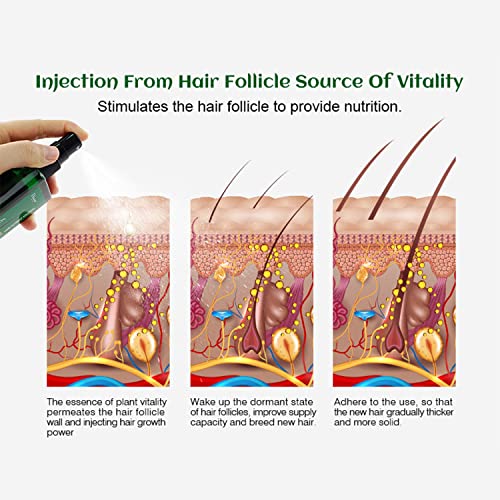 DISAAR Beauty Ginger Hair Grown Oil Spray Solution Natural Nourishing Repair Follicle Roots Melon Extract Ginseng Root Extract 120ml / 4.06fl.oz