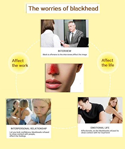 Aichun Beauty Mask Caviar Purifying Peel Off Blackhead Remover Deep Cleansing Facial Clean 120ml