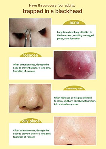 Aichun Beauty Mask Caviar Purifying Peel Off Blackhead Remover Deep Cleansing Facial Clean 120ml