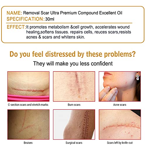 Aichun Beauty Removal Scar Premium Compound Essential Oil Repair Cells Reduces Scars Resists Acnes 30ml/1fl.oz