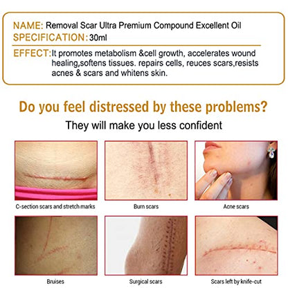 Aichun Beauty Removal Scar Premium Compound Essential Oil Repair Cells Reduces Scars Resists Acnes 30ml/1fl.oz