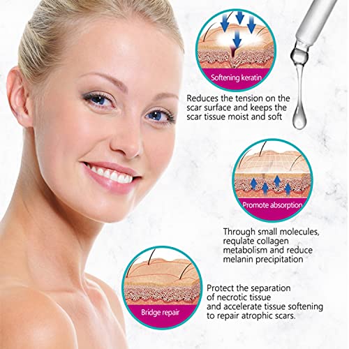 AICHUN BEAUTY Hyaluronic Acid Scars Repair Essence Repair Cells Serum Moisturizing Essential Oil Skin Scar Removal Nourish Hydrate 30ml/1.01fl.oz
