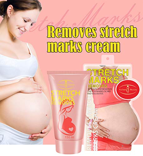 AICHUN BEAUTY Pregnancy Cream Stretch Mark Remover Scars Repair Cellulites Lotion Cream 150ml