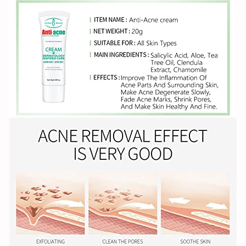 AICHUN BEAUTY Anti-Acne Cream Treats Pimple Clogged Pores Oil Control Reduces Acne Scars Shrinks Pores 20g / 0.68fl.oz