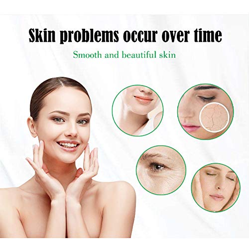 AICHUN BEAUTY Fresh White Honey Shea Butter Moisturizing Cream Remove Pimples Freckles 30ml