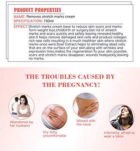AICHUN BEAUTY Pregnancy Cream Stretch Mark Remover Scars Repair Cellulites Lotion Cream 150ml