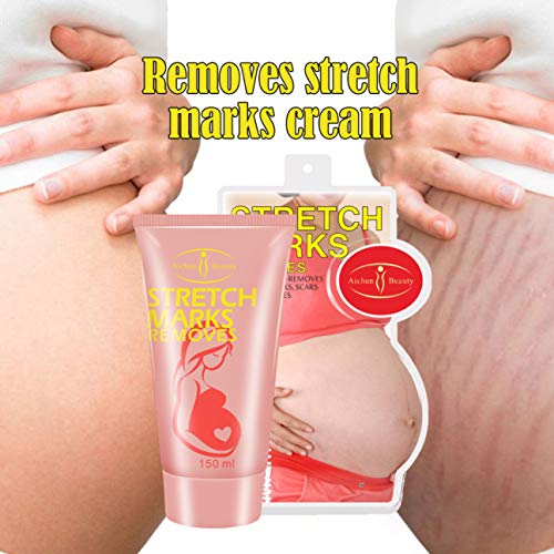 AICHUN BEAUTY Pregnancy Cream Stretch Mark Remover Scars Repair Cellulites Lotion Cream 150ml