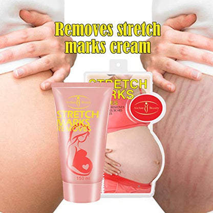 AICHUN BEAUTY Pregnancy Cream Stretch Mark Remover Scars Repair Cellulites Lotion Cream 150ml