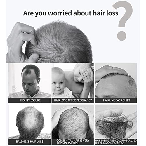 DISAAR BEAUTY Anti-Hair Loss Spray Tonic Deep Moisturize Nourish Repair Strengthen Hair Root Anti-Frizz Care 30ml / 1.01fl.oz