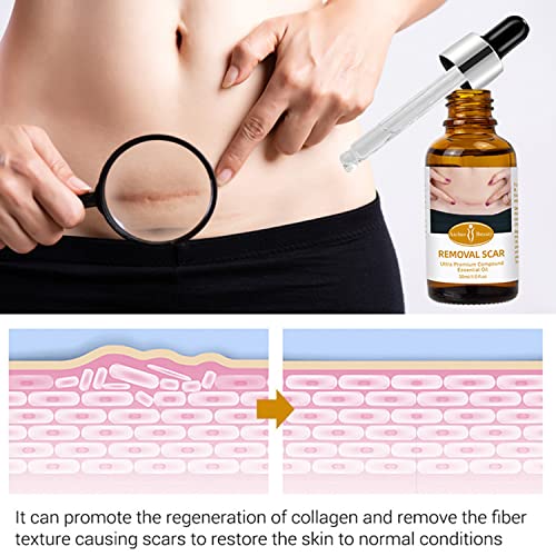 Aichun Beauty Removal Scar Premium Compound Essential Oil Repair Cells Reduces Scars Resists Acnes 30ml/1fl.oz