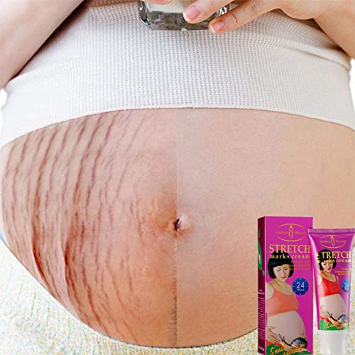AICHUN BEAUTY Stretch Marks Cream Snail Extract Reduce Skin Scars Remove Damaged Skin Cells 120g/4.23oz