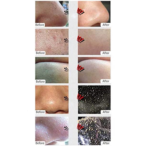 Aichun Beauty Blackhead Remover Black Mask Deep Cleansing Peel-off Mask for Blackheads Remove,Tearing Style Deep Cleansing Purifying - Activated Charcoal, 50gram