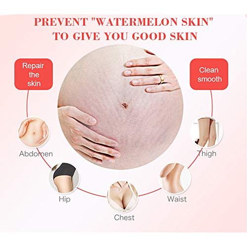 AICHUN BEAUTY Pregnancy Cream Stretch Mark Remover Scars Repair Cellulites Lotion Cream 150ml