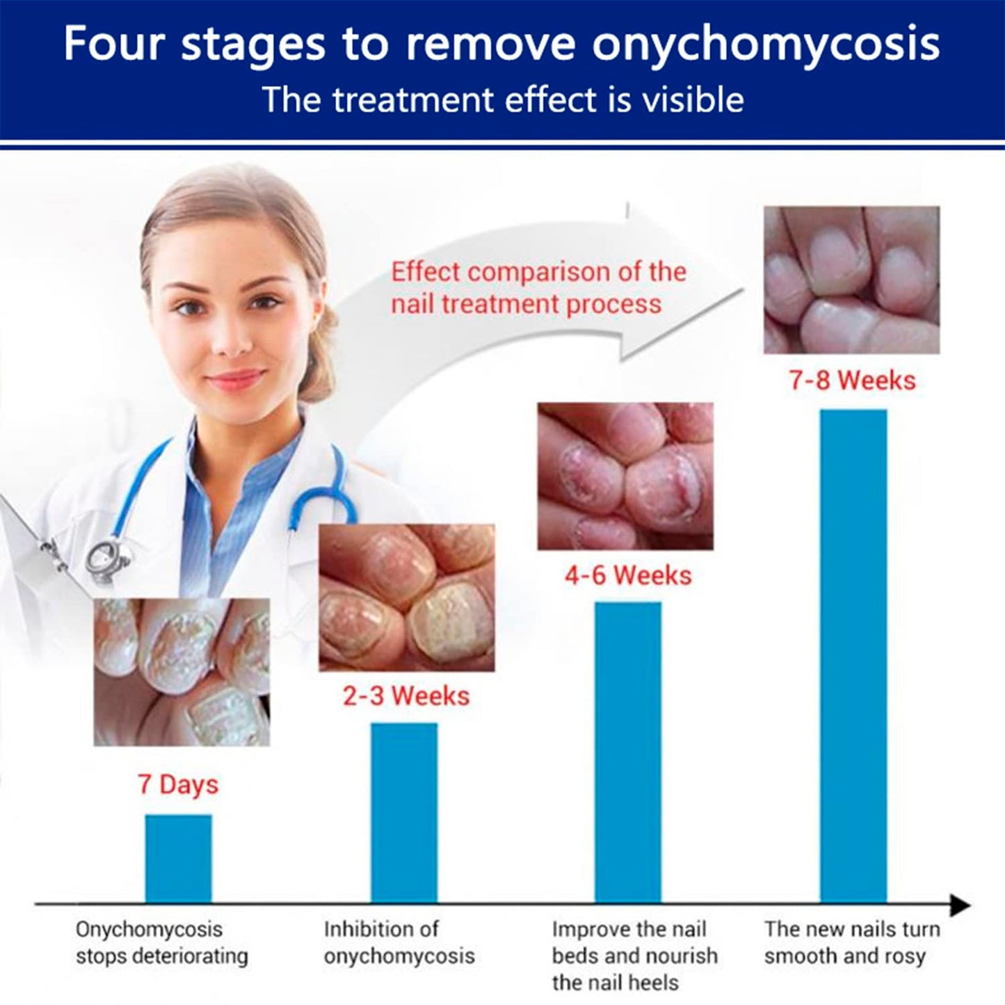 AICHUN BEAUTY Nail Repair Cream Toenails Fingernails Care Anti Fungus Restores Damaged Nails Nourishes Hydrates Skin 20g / 0.68fl.oz