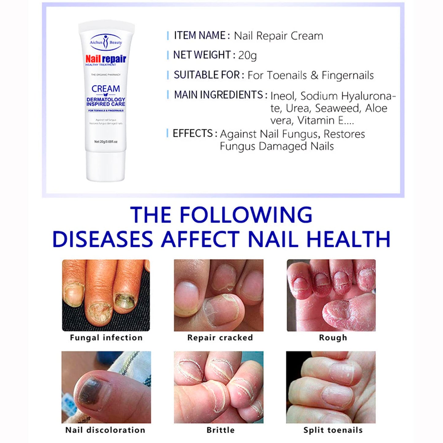 AICHUN BEAUTY Nail Repair Cream Toenails Fingernails Care Anti Fungus Restores Damaged Nails Nourishes Hydrates Skin 20g / 0.68fl.oz