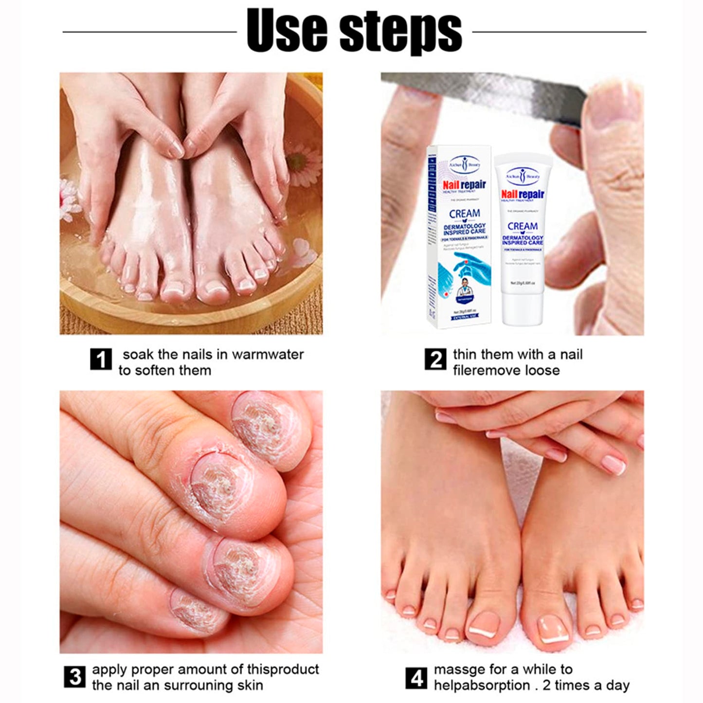 AICHUN BEAUTY Nail Repair Cream Toenails Fingernails Care Anti Fungus Restores Damaged Nails Nourishes Hydrates Skin 20g / 0.68fl.oz