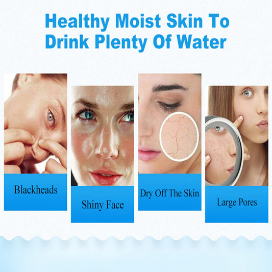 AICHUN BEAUTY Ice Face Mask Hyaluronic Acid After Sun Repair Refresh Moisturizing Relieves Pain Acne Scars Facial Skin Care 25ml / 0.88fl.oz (10 Pack)