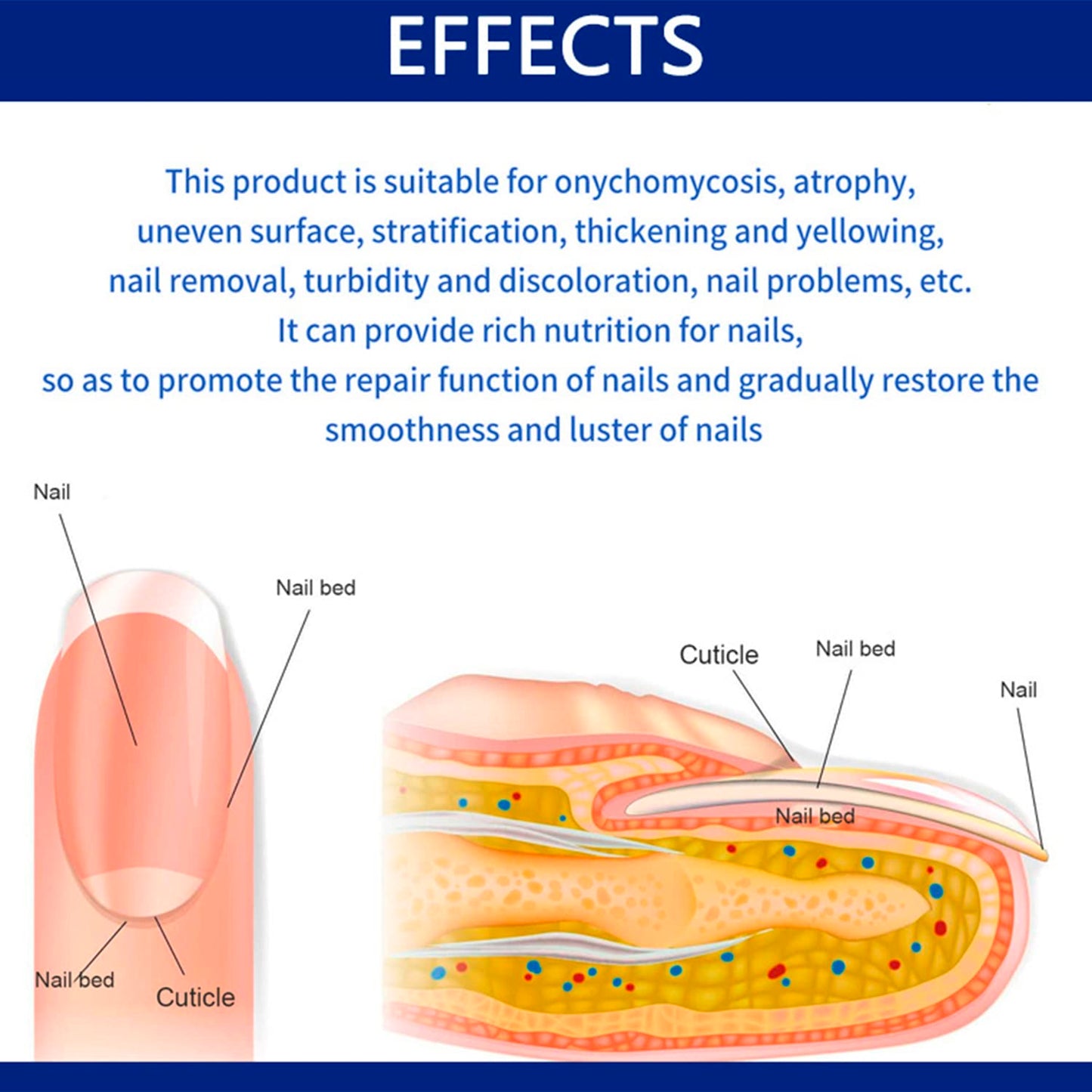 AICHUN BEAUTY Nail Repair Cream Toenails Fingernails Care Anti Fungus Restores Damaged Nails Nourishes Hydrates Skin 20g / 0.68fl.oz