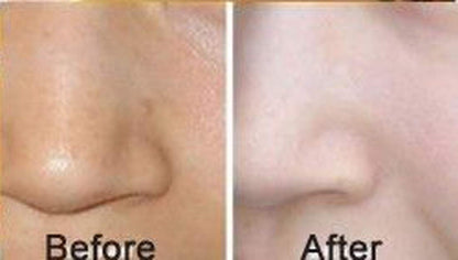 AICHUN BEAUTY Luxurious 24K Gold Bio-Collagen Facial Mask (5pcs)
