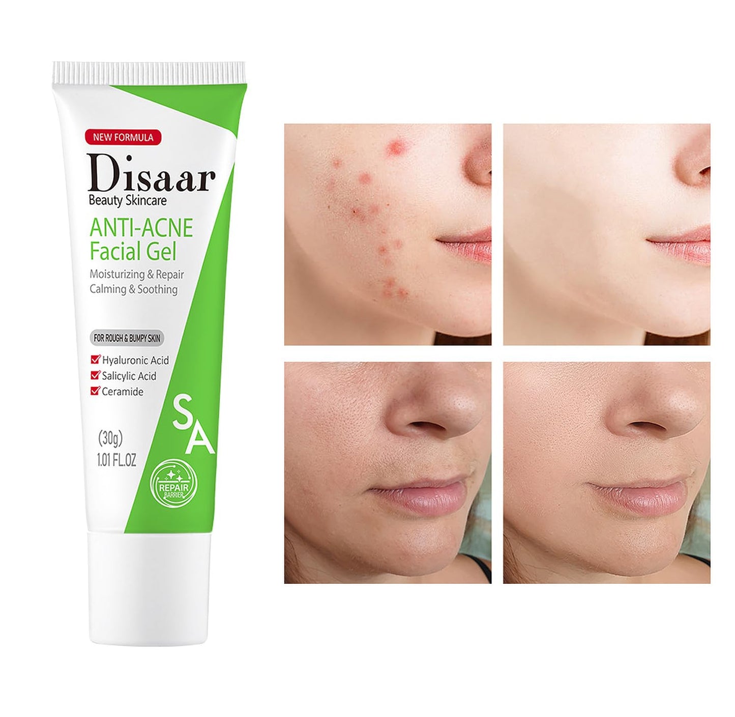 DISAAR BEAUTY Facial Gel Moisturizer with Salicylic Acid 30g