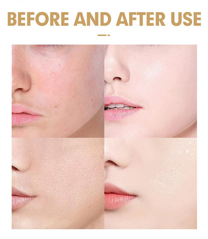DISAAR Beauty Niacinamide Facial Lotion Elasticity Moisturizing 100ml
