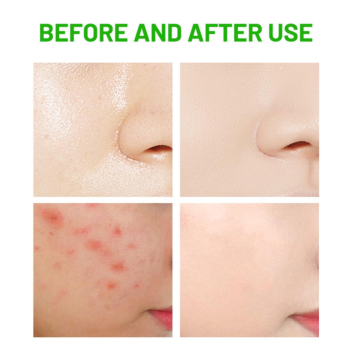 DISAAR BEAUTY Rosemary Centella Facial Wash Anti-Acne 100g
