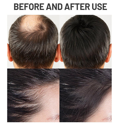 DISAAR BEAUTY Hair Growth Spray Minoxidil Caffeine Biotin 240ml (Caffeine)